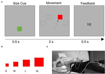 Evaluating the Abnormality of Bilateral Motor Cortex Activity in Subacute Stroke Patients Executing a Unimanual Motor Task With Increasing Demand on Precision